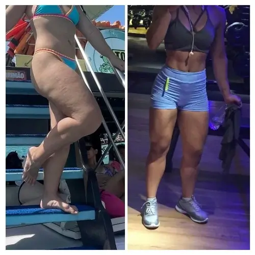 Resultado Lymphoderm